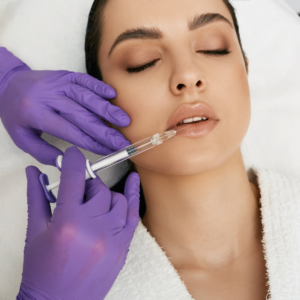 woman having lip dermal fillers to volumes lips 